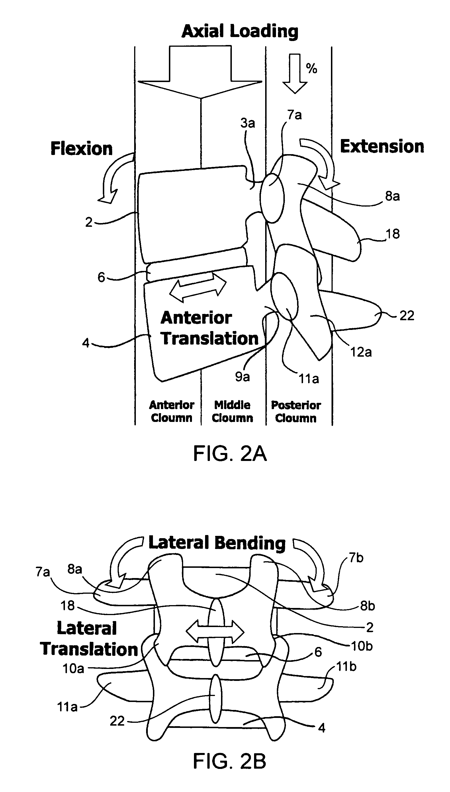 Systems and methods for posterior dynamic stabilization of the spine