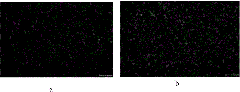 Culture method of bone marrow derived endothelial progenitor cells