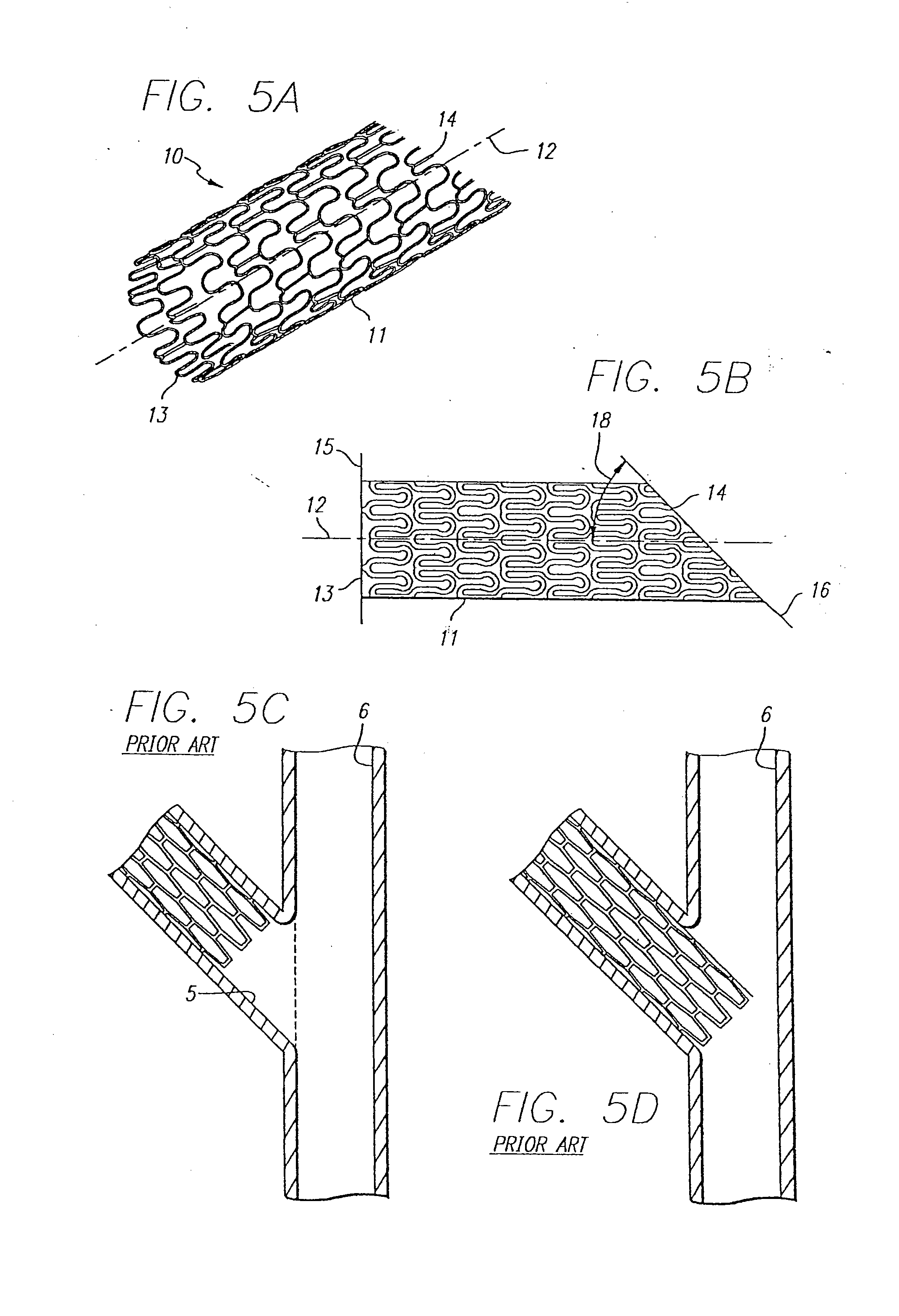 Stent and catheter assembly and method for treating bifurcations