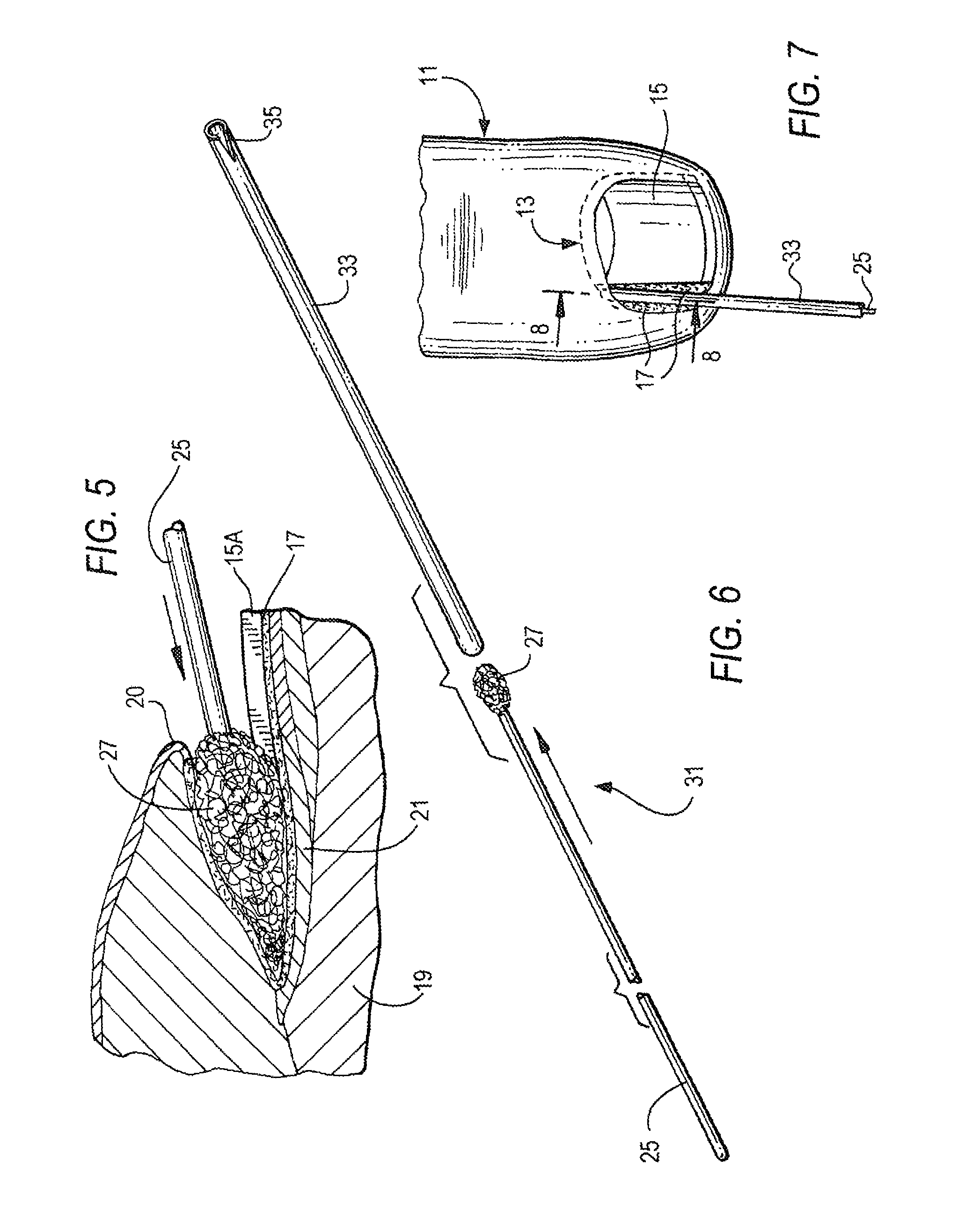 Podiatric system