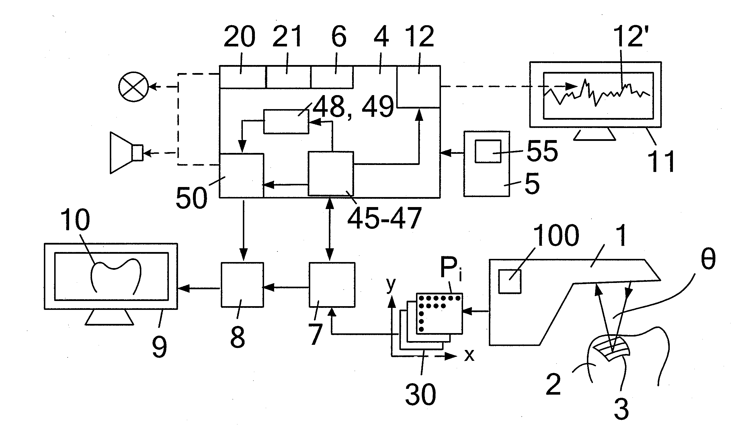 Method and device for optical scanning of three-dimensional objects by means of a dental 3D camera using a triangulation method