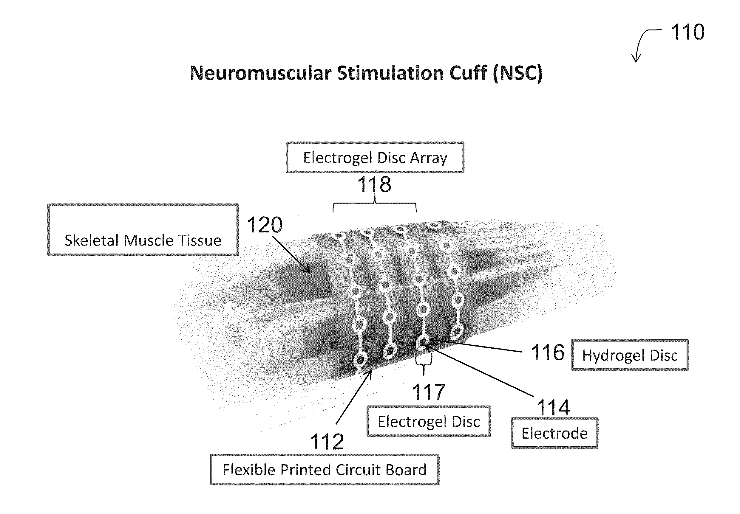 Neural sleeve for neuromuscular stimulation, sensing and recording