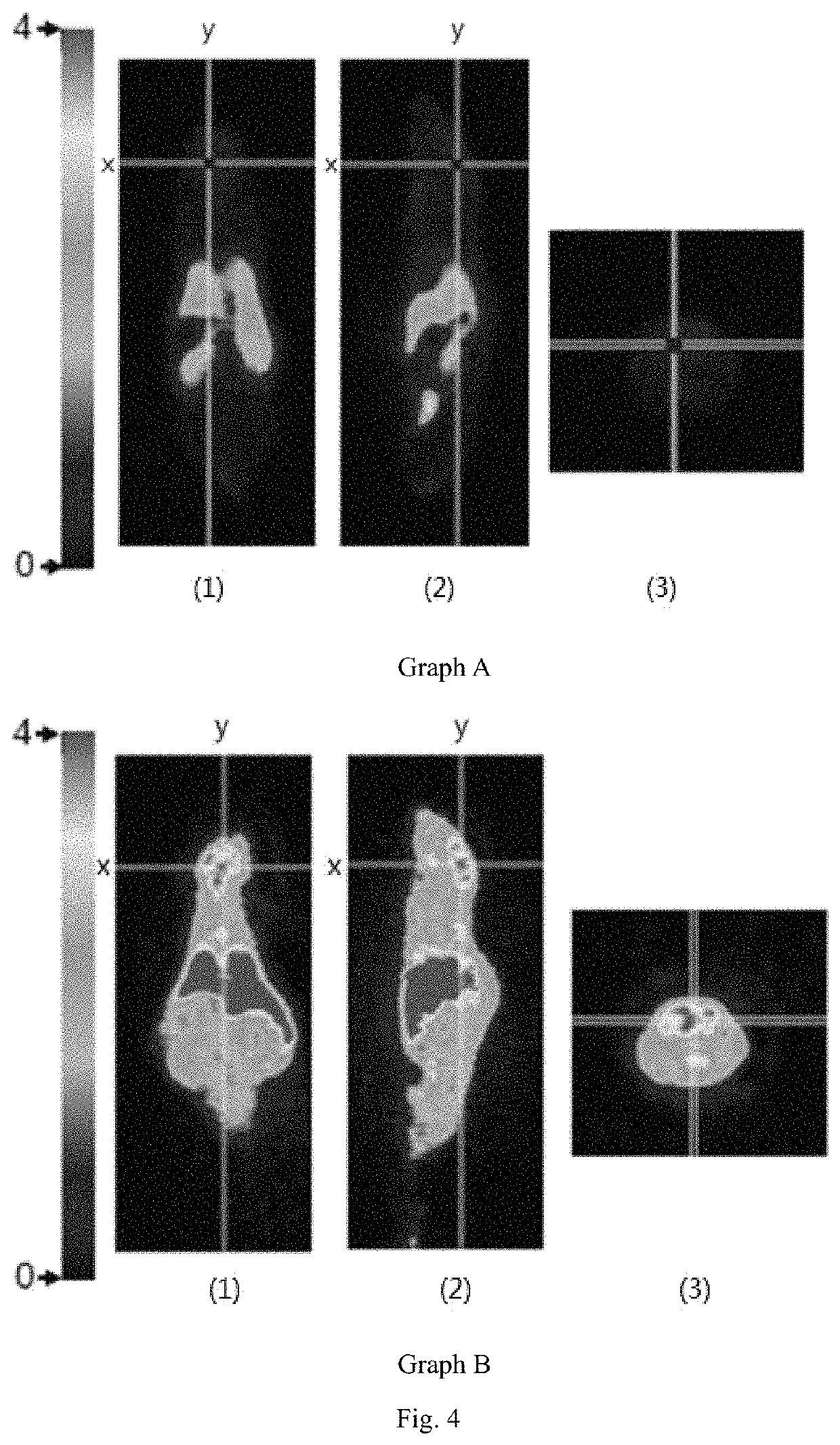 Neutron capture therapy system for eliminating amyloid β-protein