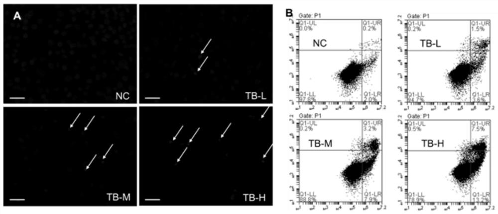 Application of theabrownin in preparation of medicine for treating liver cancer