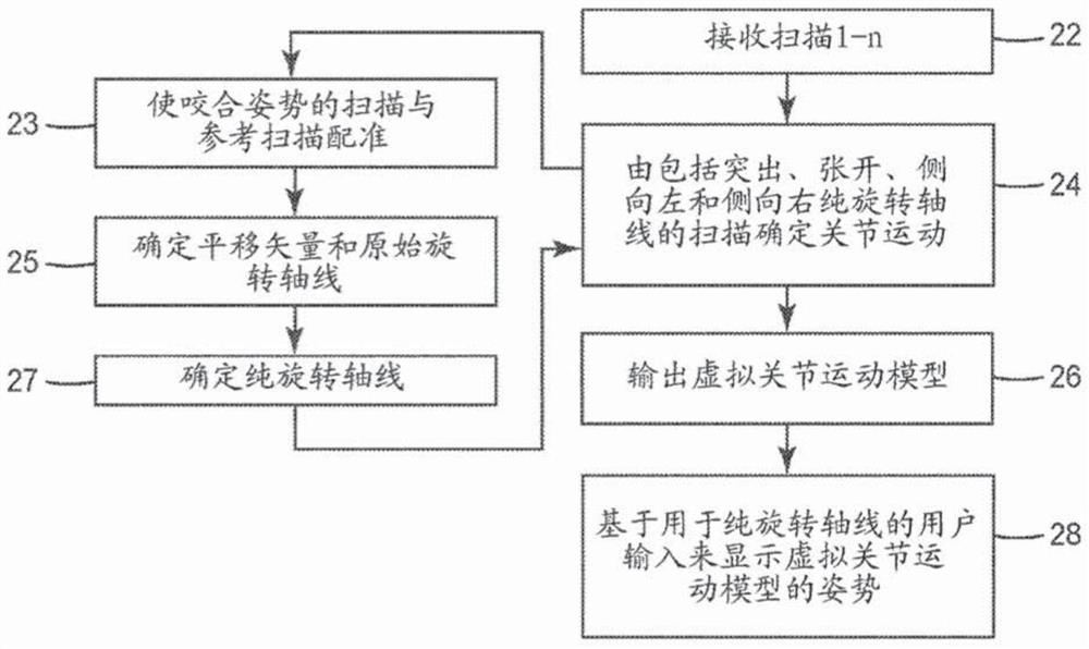 Virtual model of articulation derived from intraoral scans