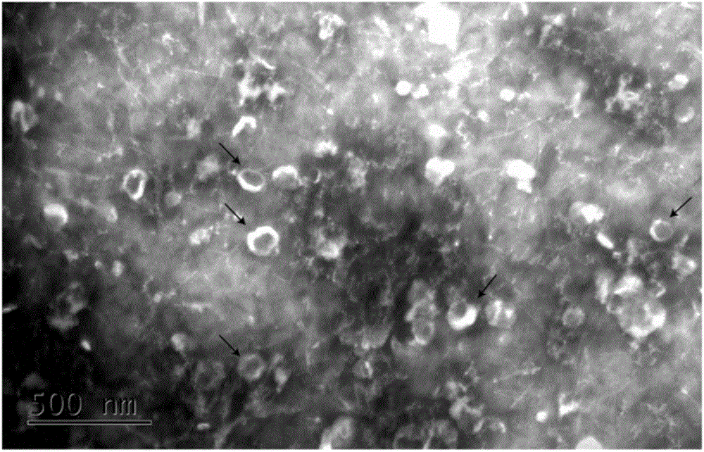 Tissue-derived exosome extraction method and application thereof