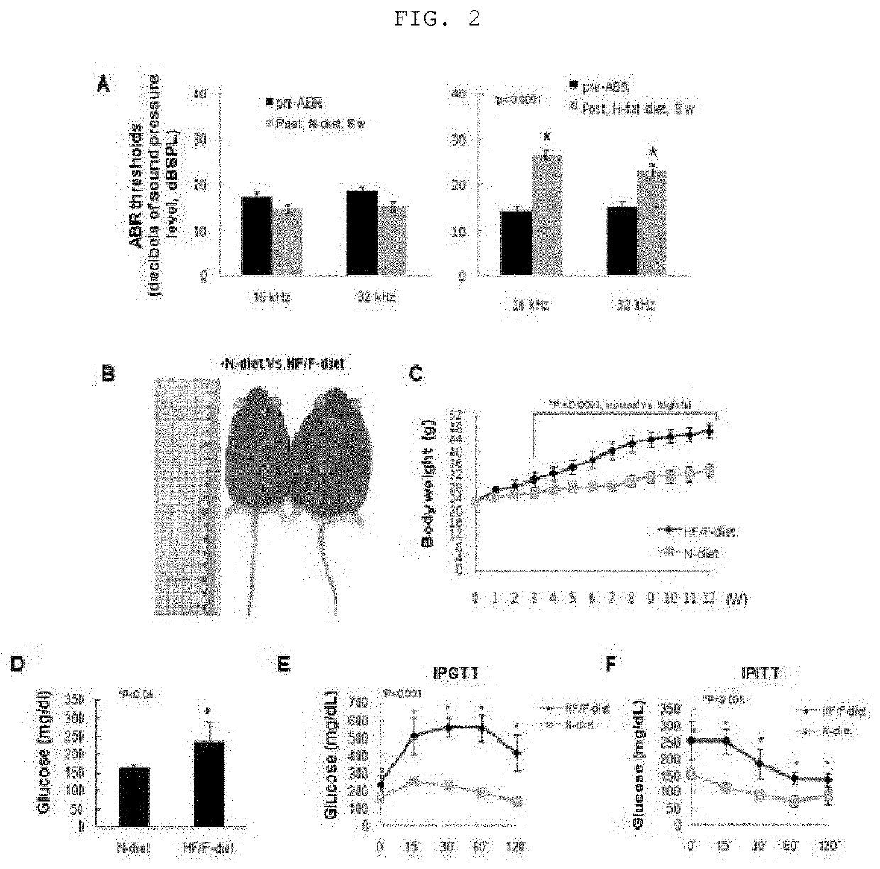 Composition for preventing or treating hearing loss, containing atorvastatin as active ingredient