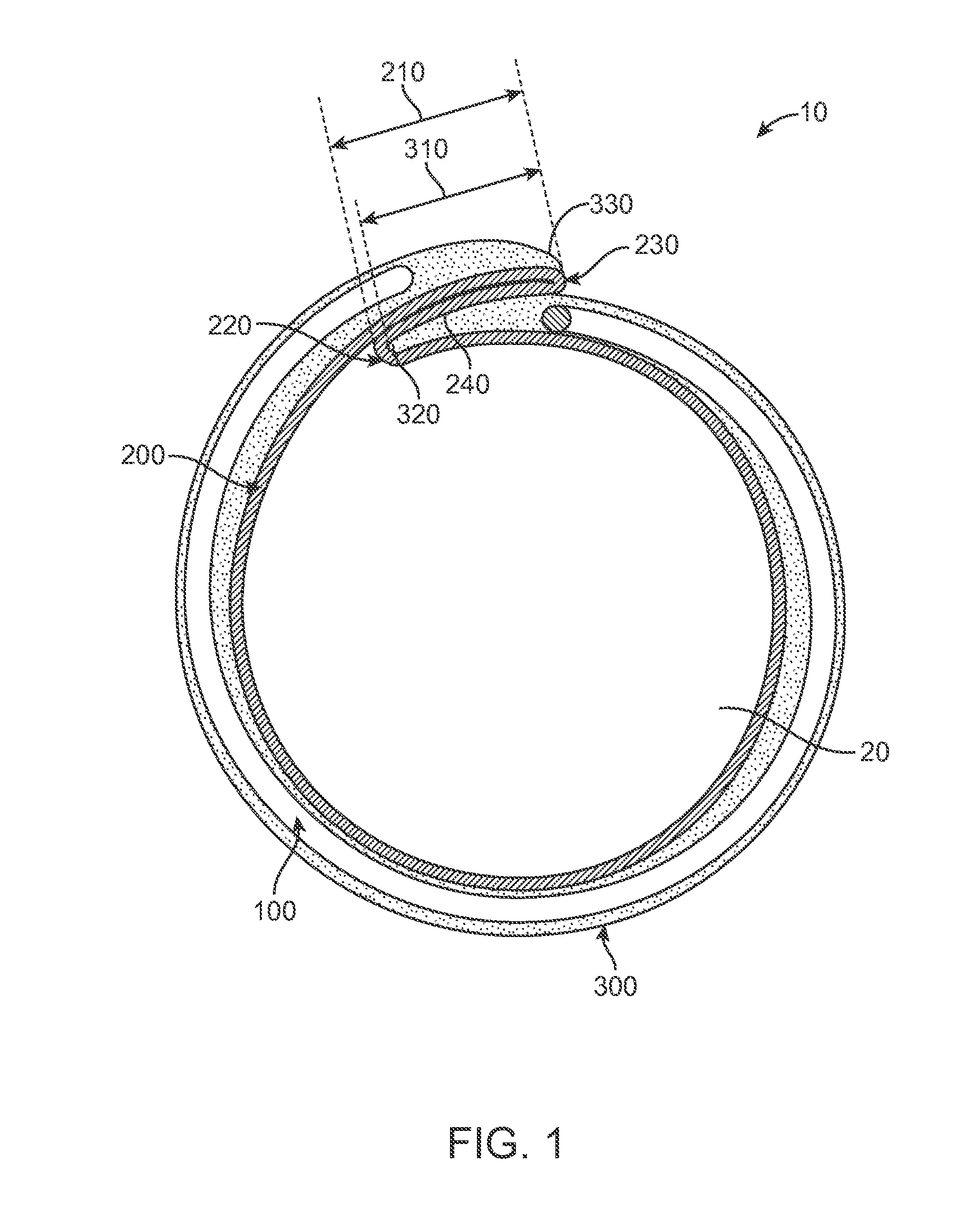 Elastic Introducer Sheath