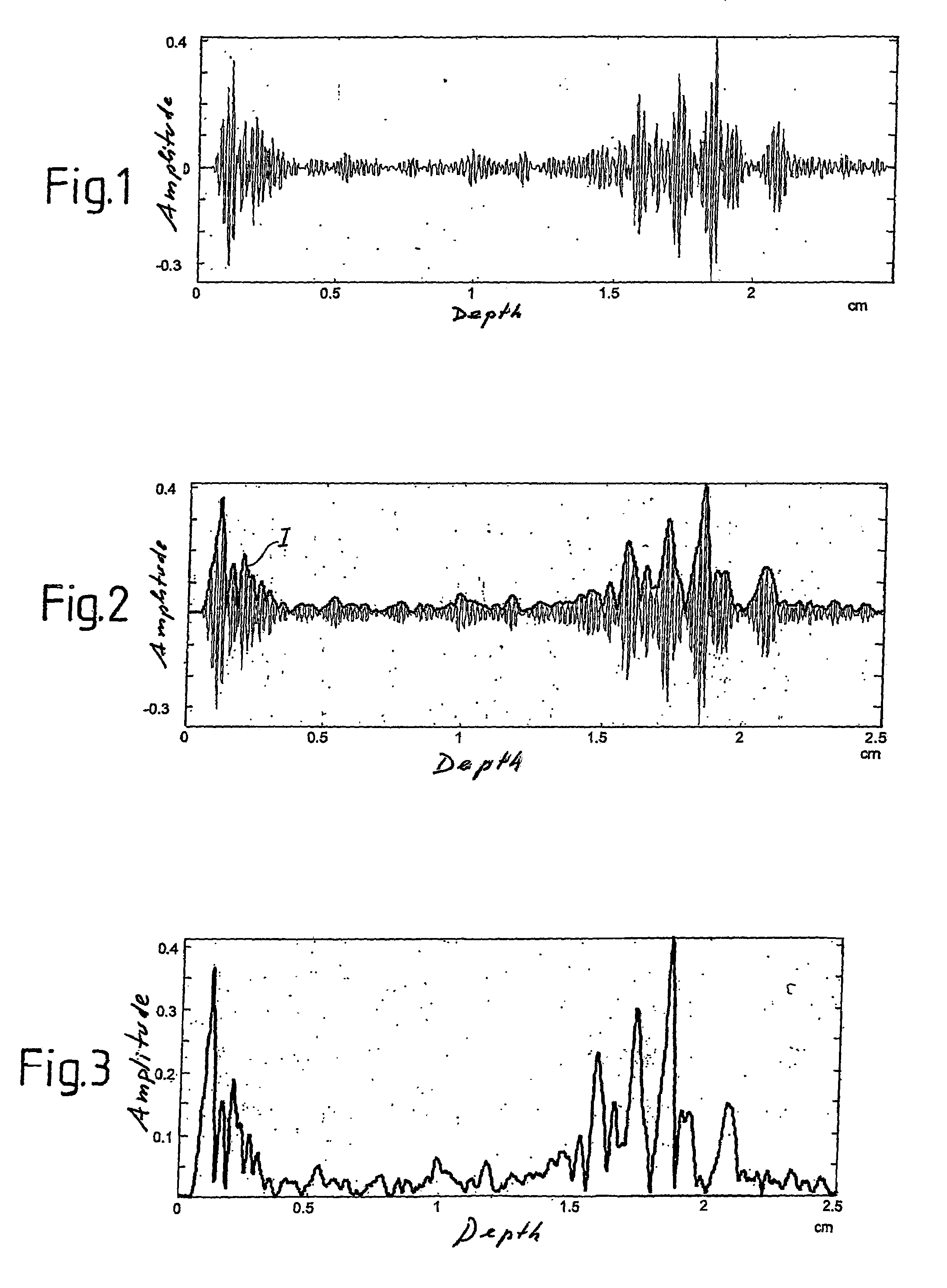 Method and device for local spectral analysis of an ultrasonic signal