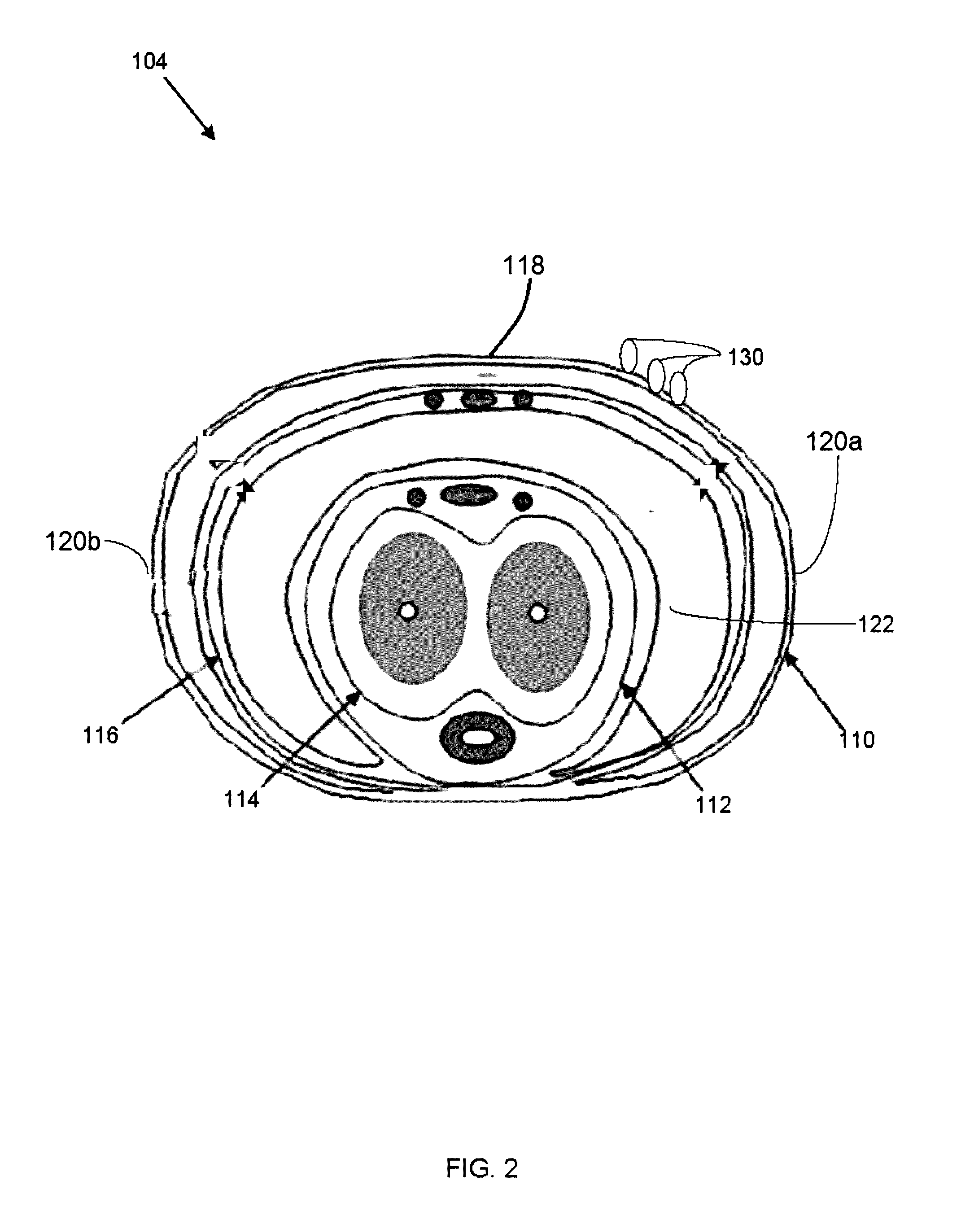 Minimally Invasive Method of Augmenting a Glans Penis with Intradermal Filler Material