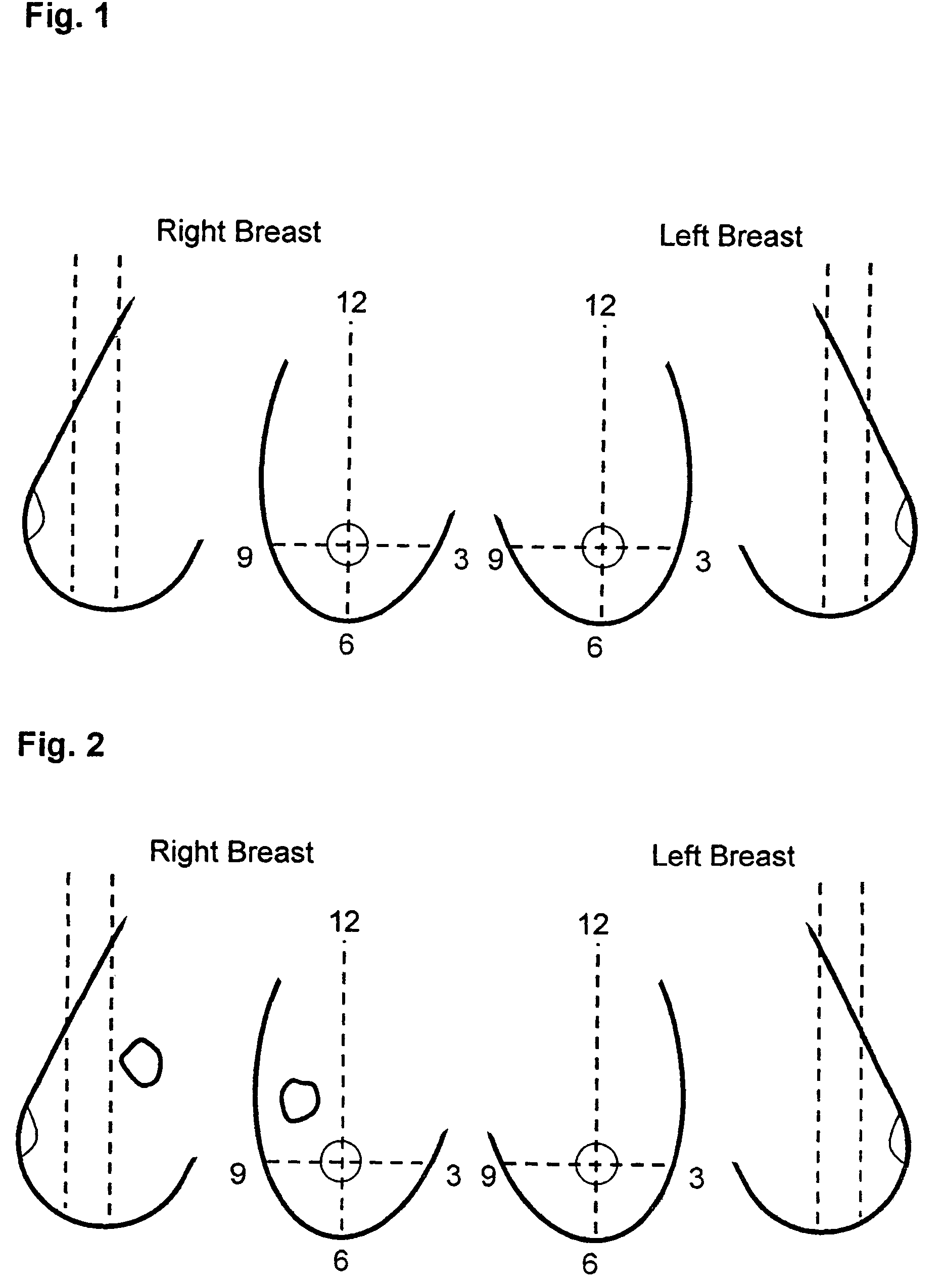 Use of computer-aided detection system outputs in clinical practice