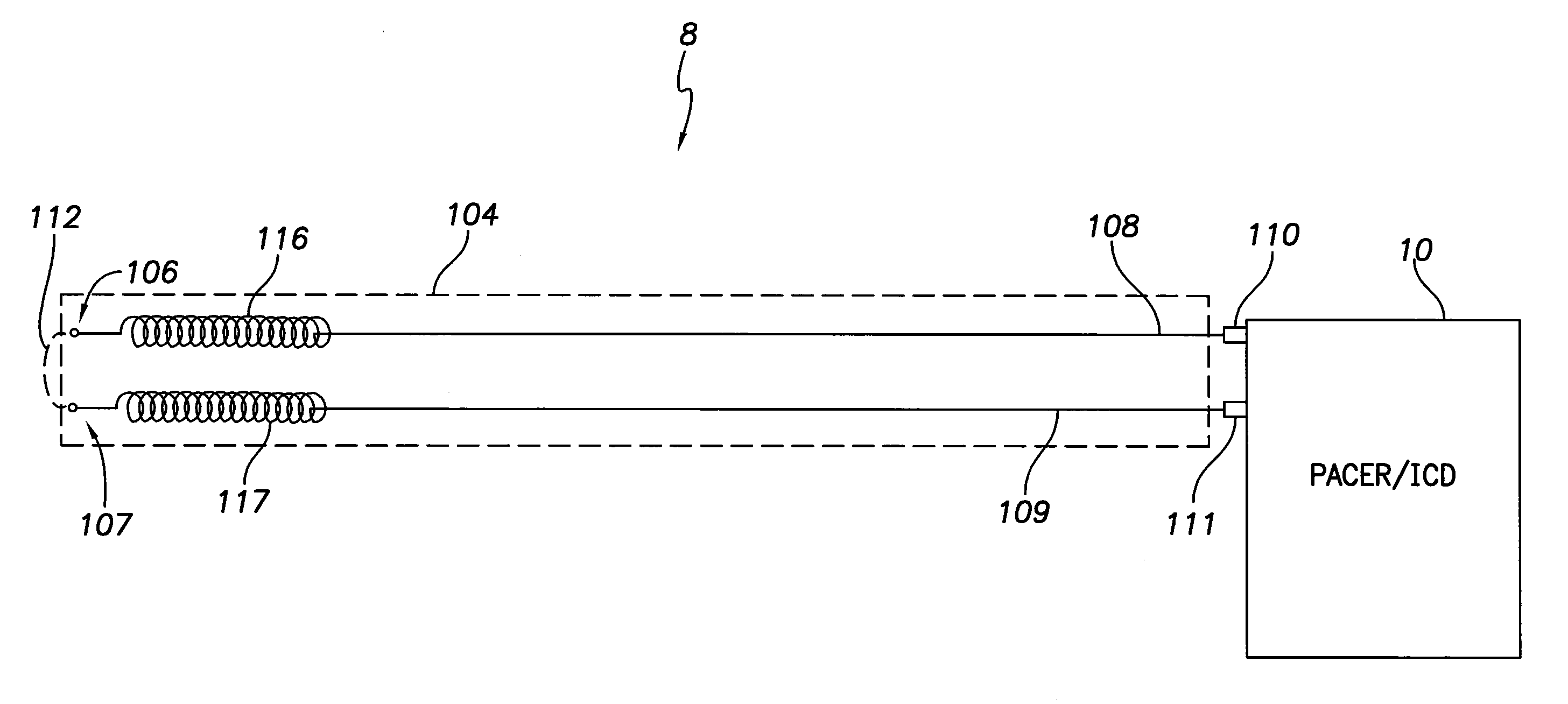 Implantable medical device lead incorporating insulated coils formed as inductive bandstop filters to reduce lead heating during MRI