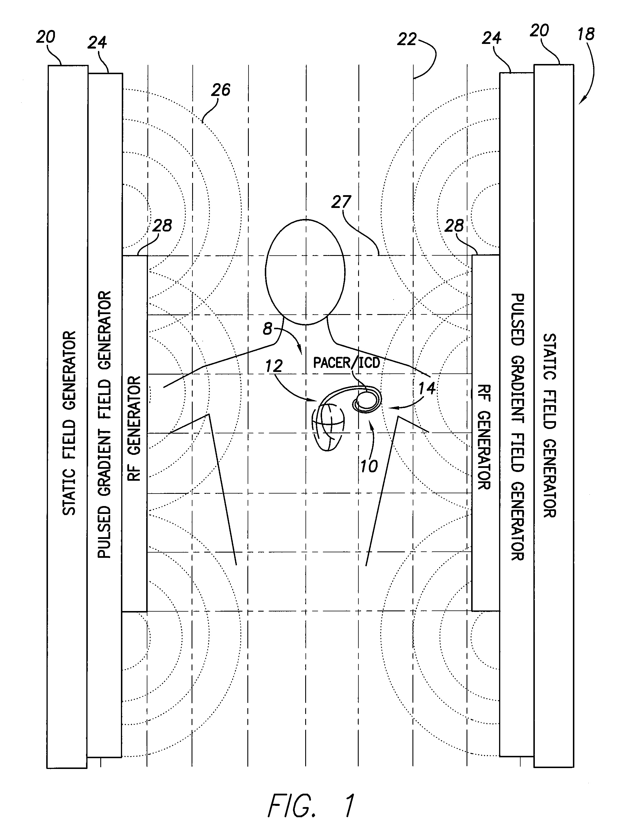 Implantable medical device lead incorporating insulated coils formed as inductive bandstop filters to reduce lead heating during MRI