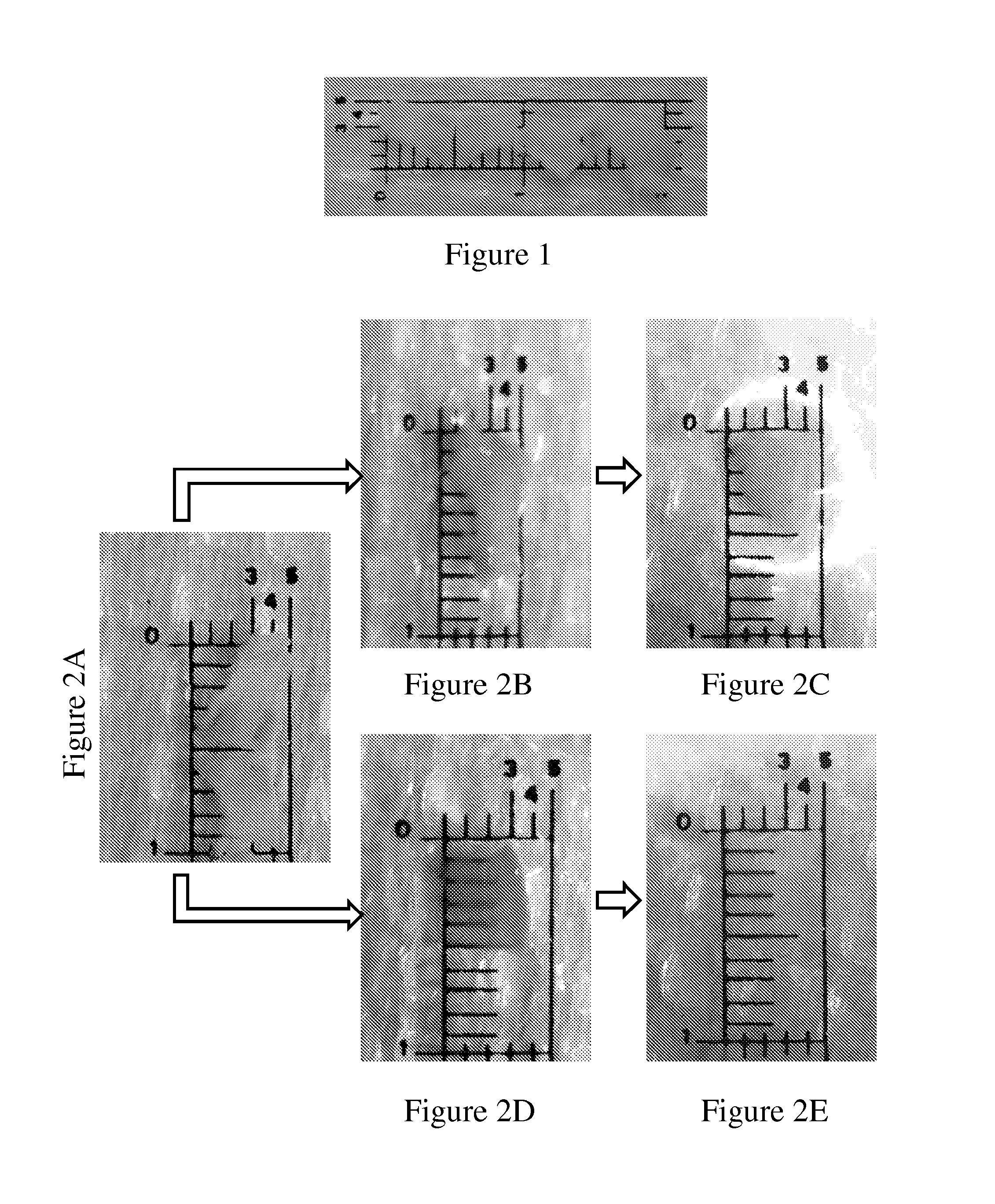 Methods For Extracting A Tooth