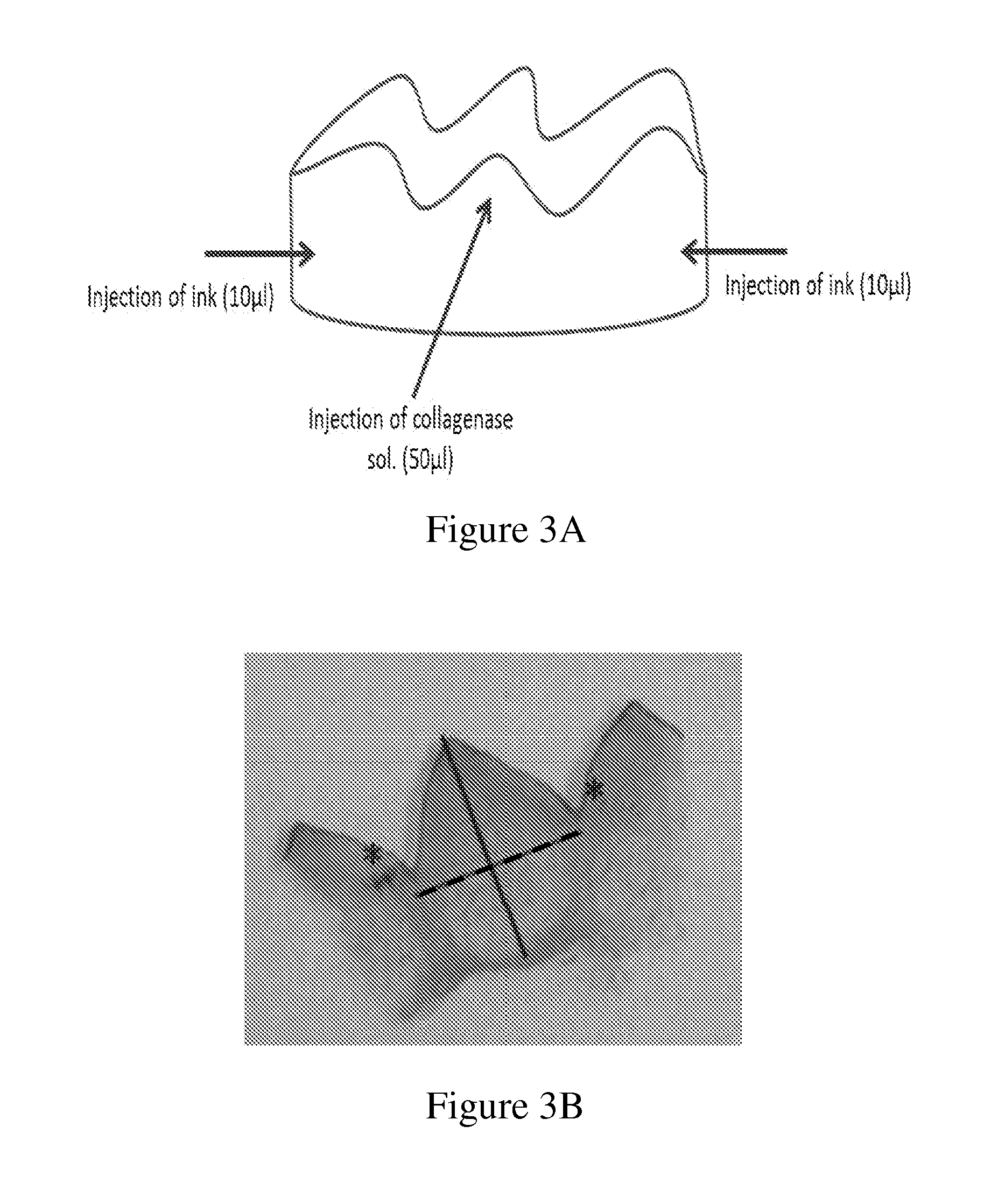 Methods For Extracting A Tooth