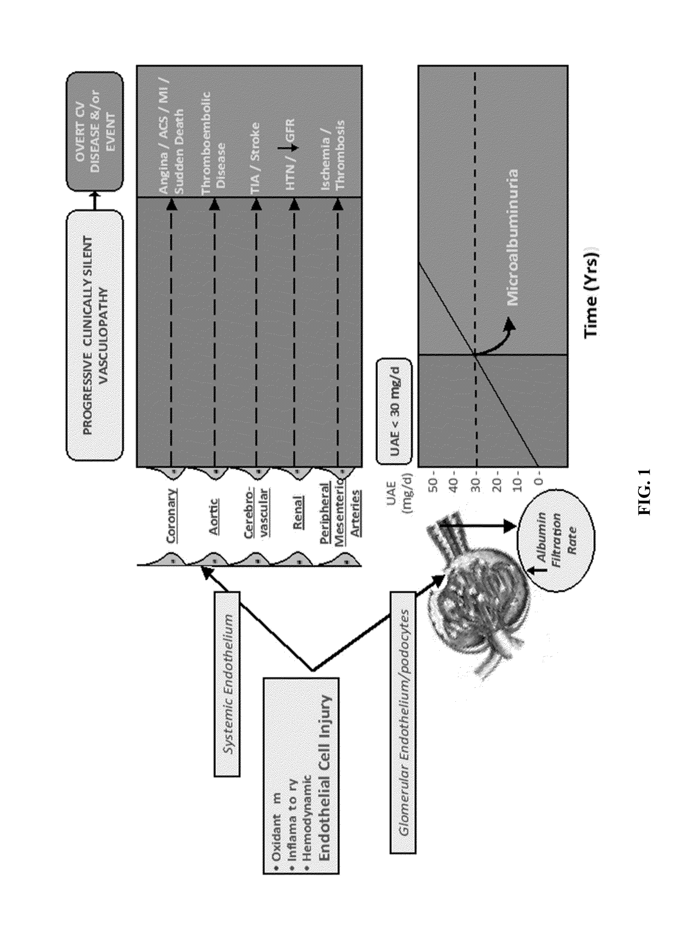 Determination of risk for development of cardiovascular disease by measuring urinary levels of podocin and nephrin messenger RNA