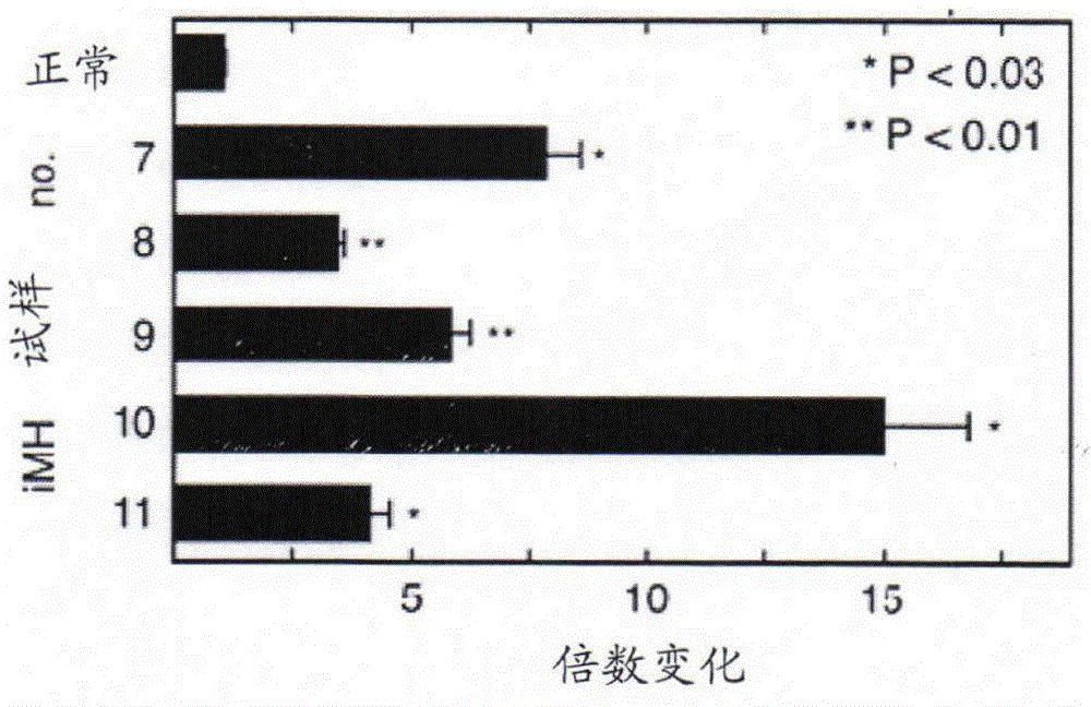 Detection method and kit for porous dental hydroxyapatite