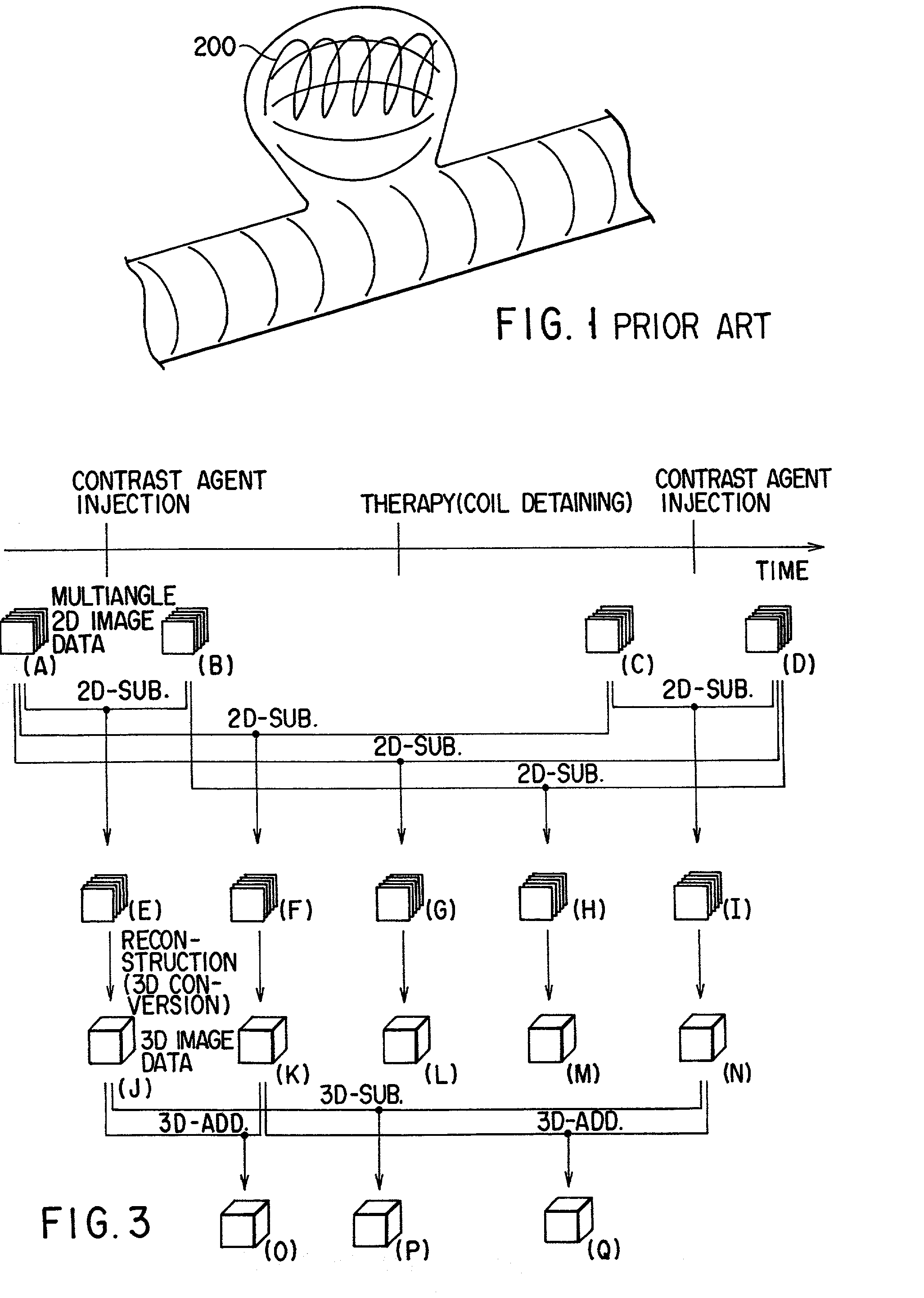 X-ray diagnosis apparatus