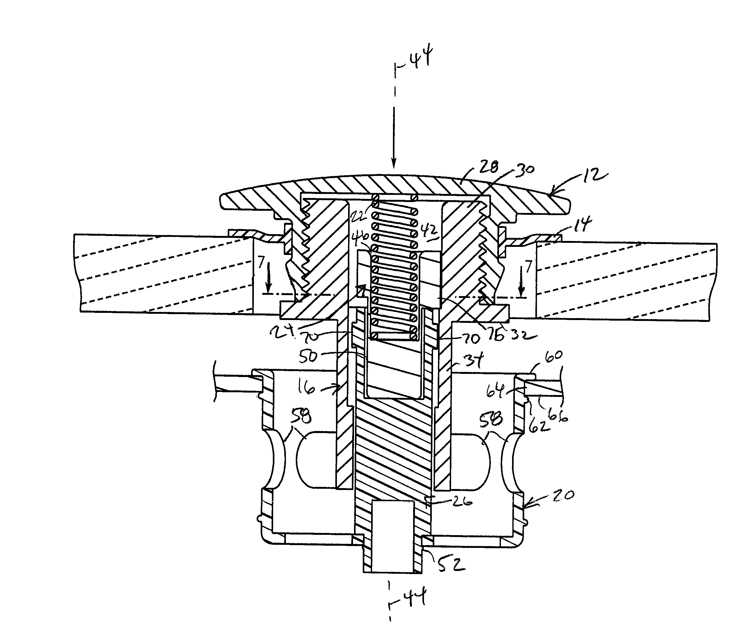 Removable pop-up drain control with catch basket