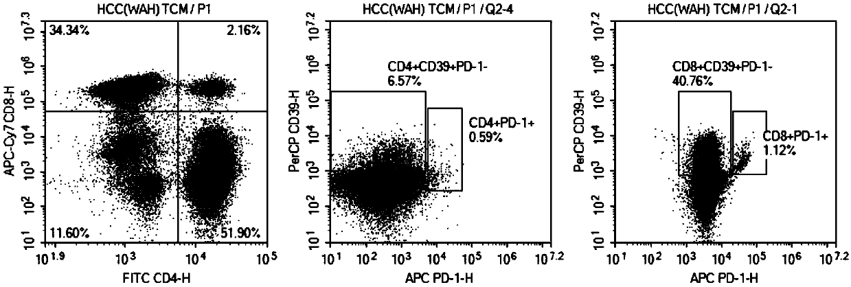 Application of memory lymphocyte population in liver cancer treatment