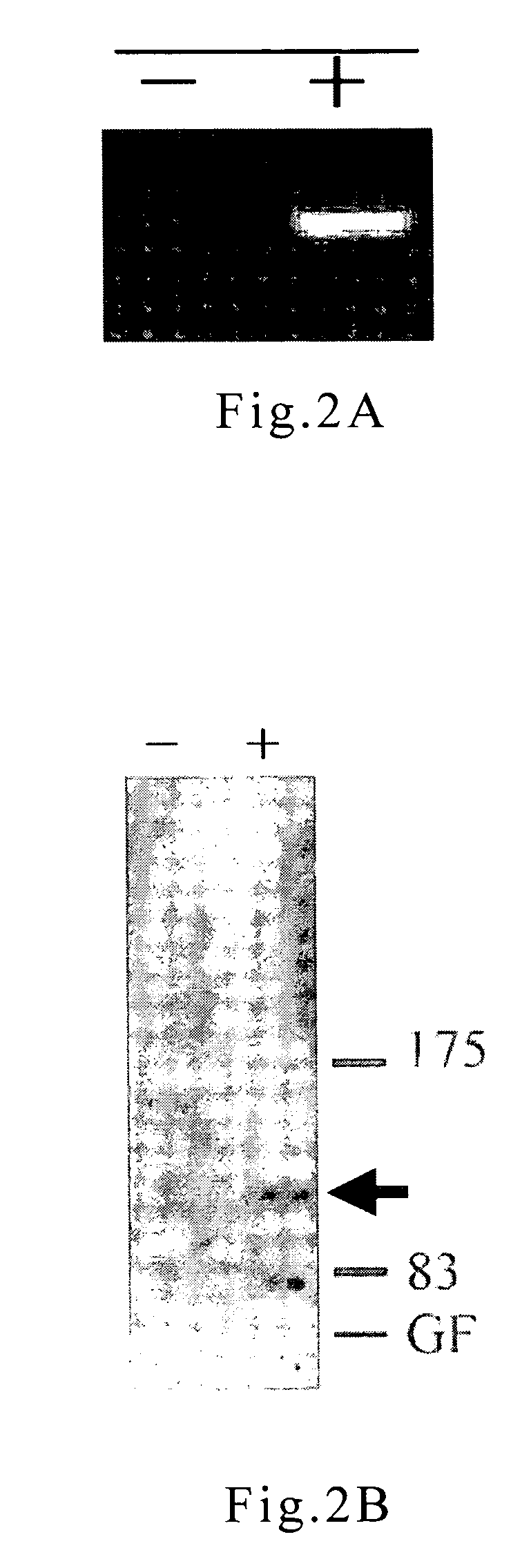 Cell culture and method for screening for a compound useful in the treatment or prevention of hepatic cirrhosis