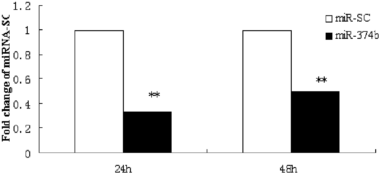 Applications of ssc-miR-374b-5p in preparation of drugs for reducing fat deposition and/or resisting fat-related diseases