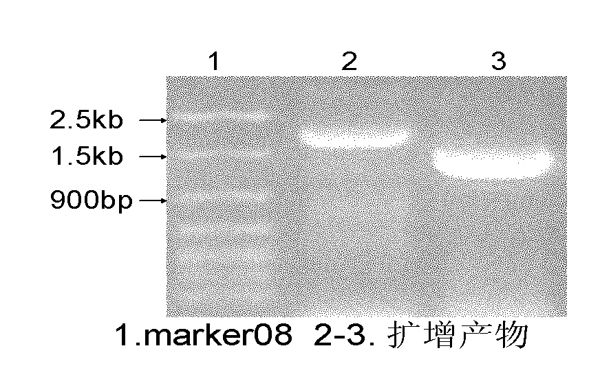 Preparation method of immortalized human intervertebral disc nucleus pulposus cell system