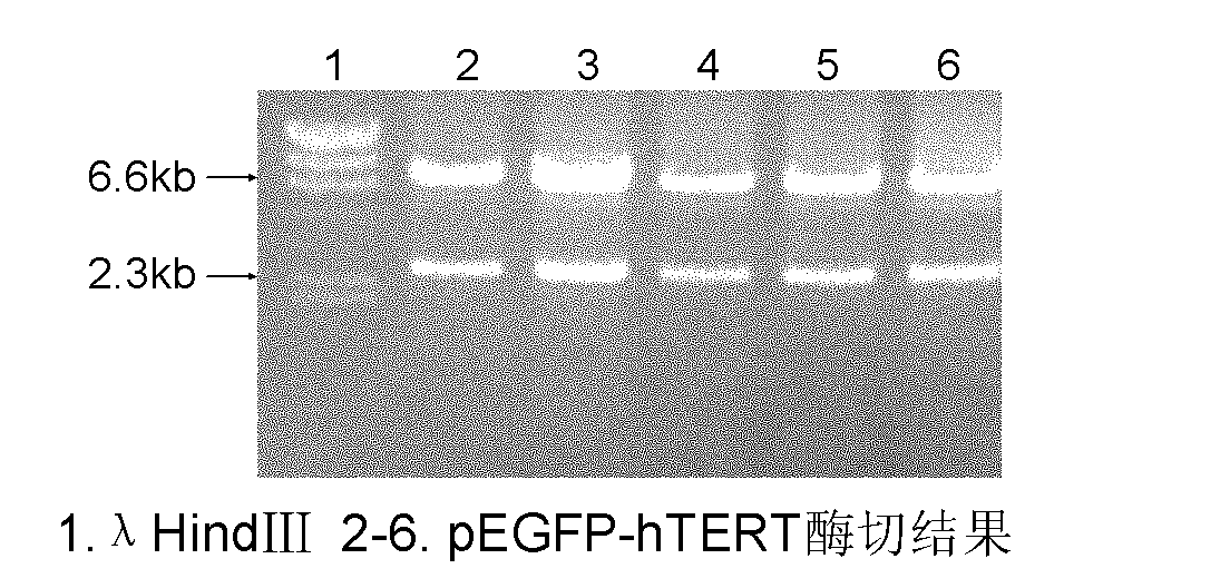 Preparation method of immortalized human intervertebral disc nucleus pulposus cell system