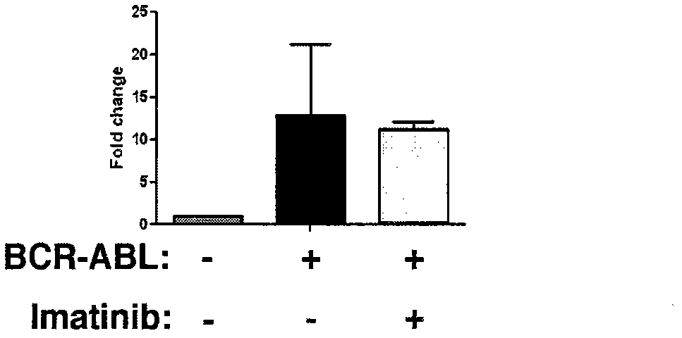 Application of 5-LO (lipoxygenase) inhibitor for treatment of malignant tumor in blood system