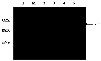 Chicken infectious bursal disease virus VP2 gene, expression product and subunit vaccine thereof, and application of vaccine