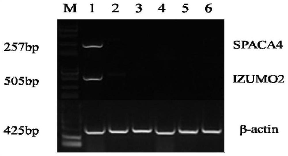 A sperm protein marker spaca4 closely related to the reproductive performance of breeding boars and its application