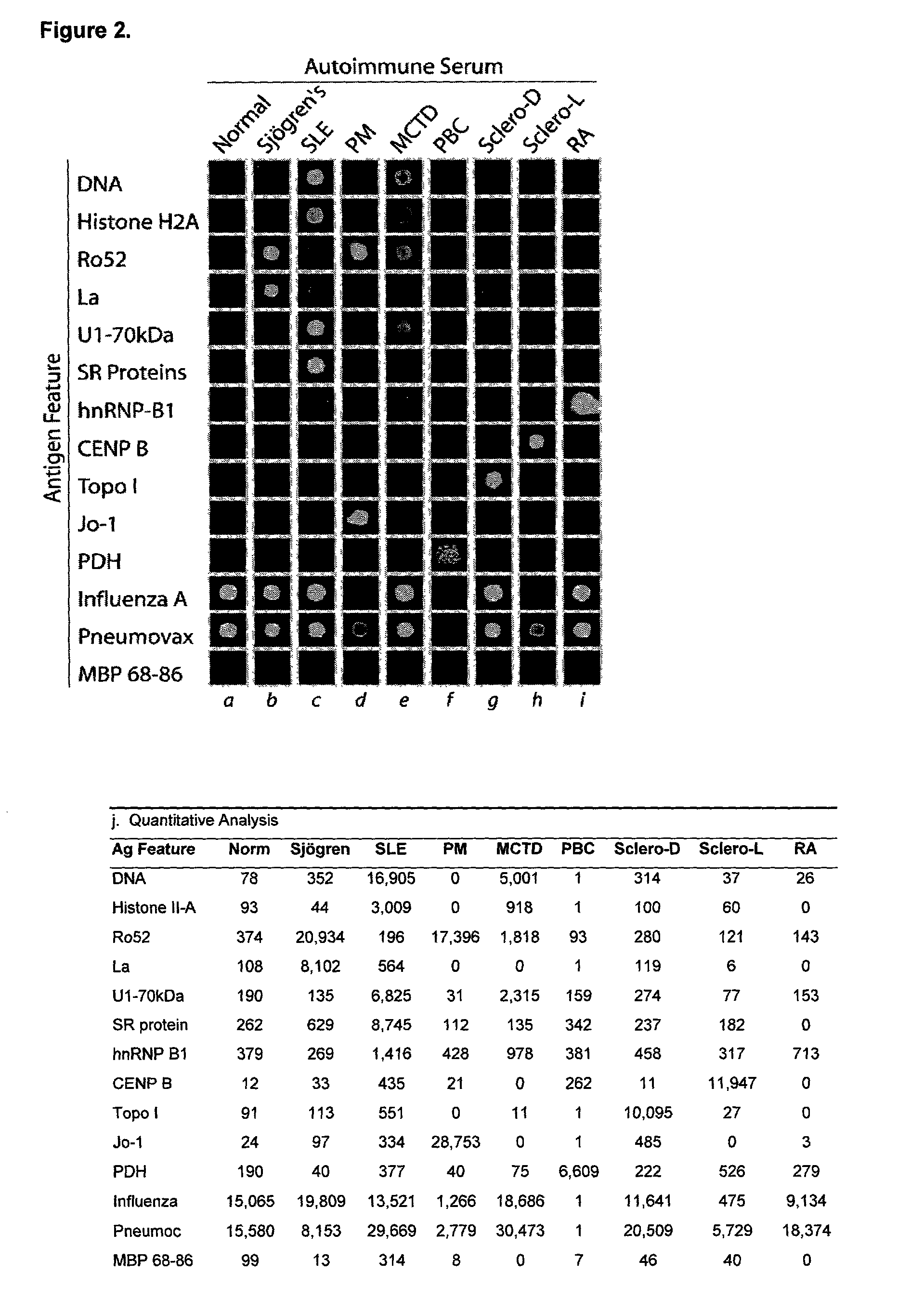 Therapeutic and diagnostic uses of antibody specificity profiles