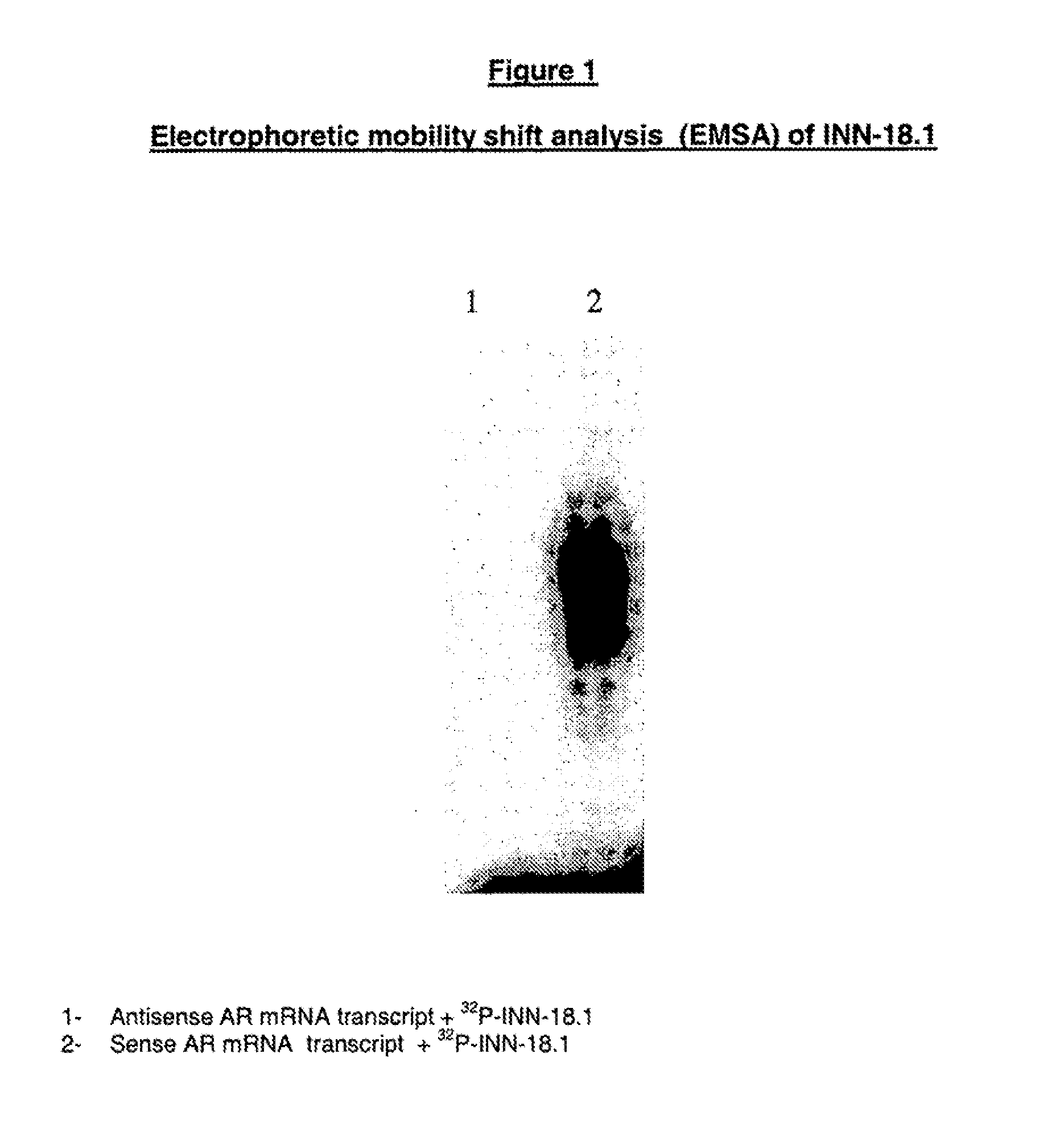 Antiandrogen oligonucleotides usable for the treatment of dermatological androgen-related disorders relating to androgen metabolism, their pharmaceutical compositions, their uses and treatment method