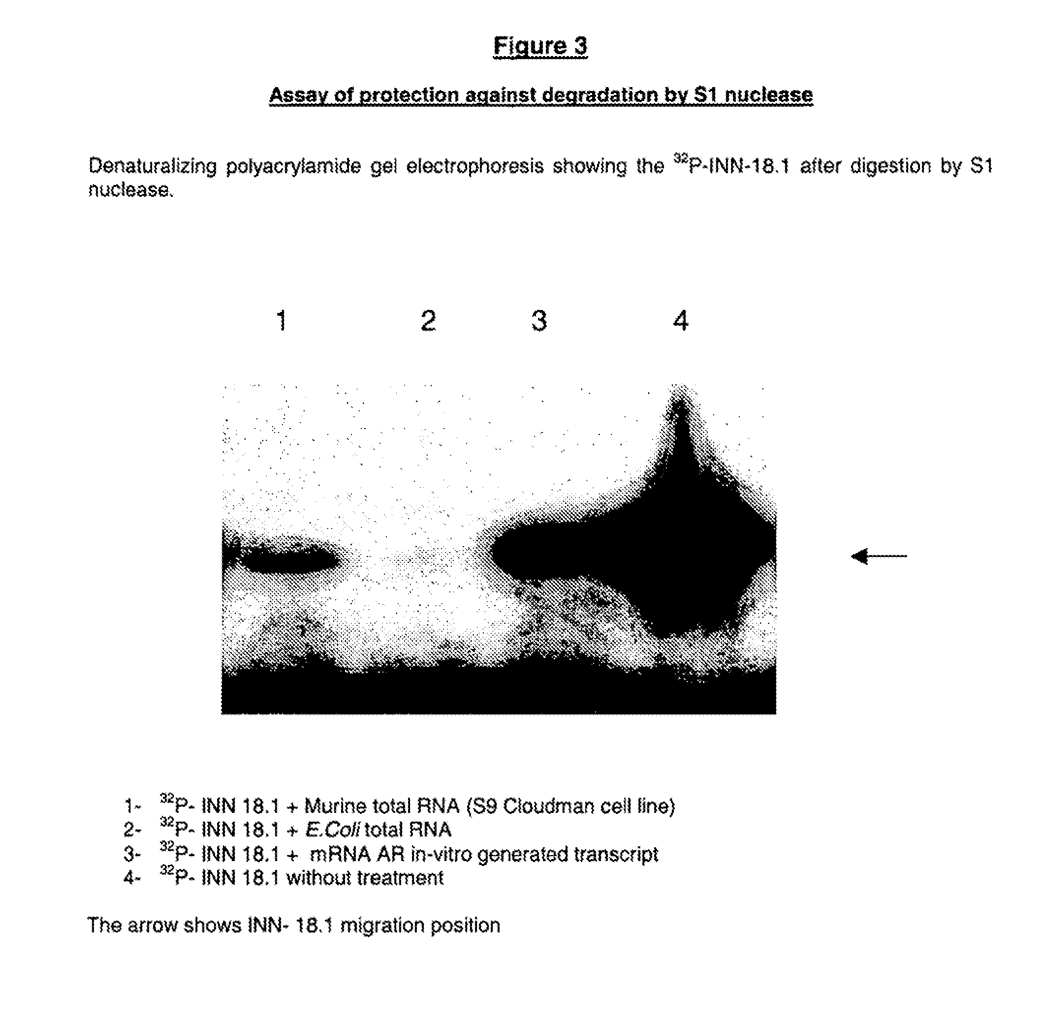 Antiandrogen oligonucleotides usable for the treatment of dermatological androgen-related disorders relating to androgen metabolism, their pharmaceutical compositions, their uses and treatment method