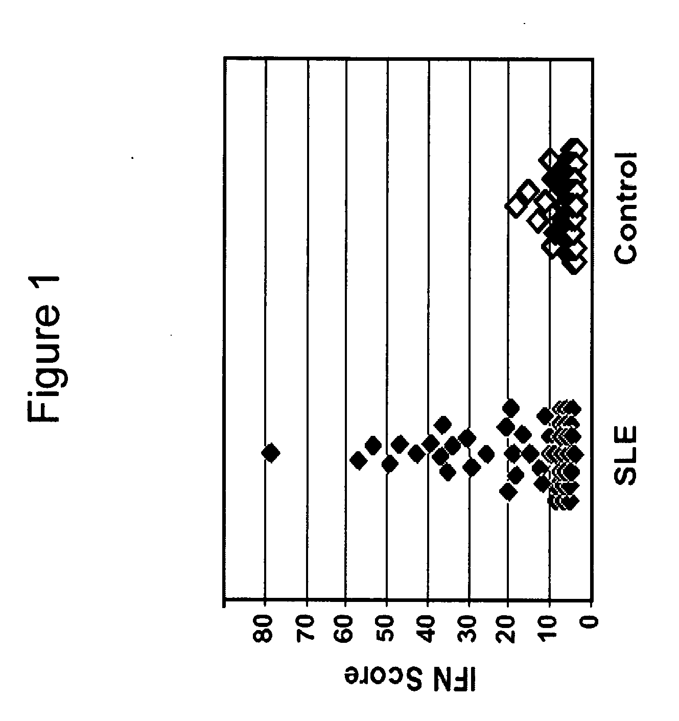 Systemic lupus erythematosus