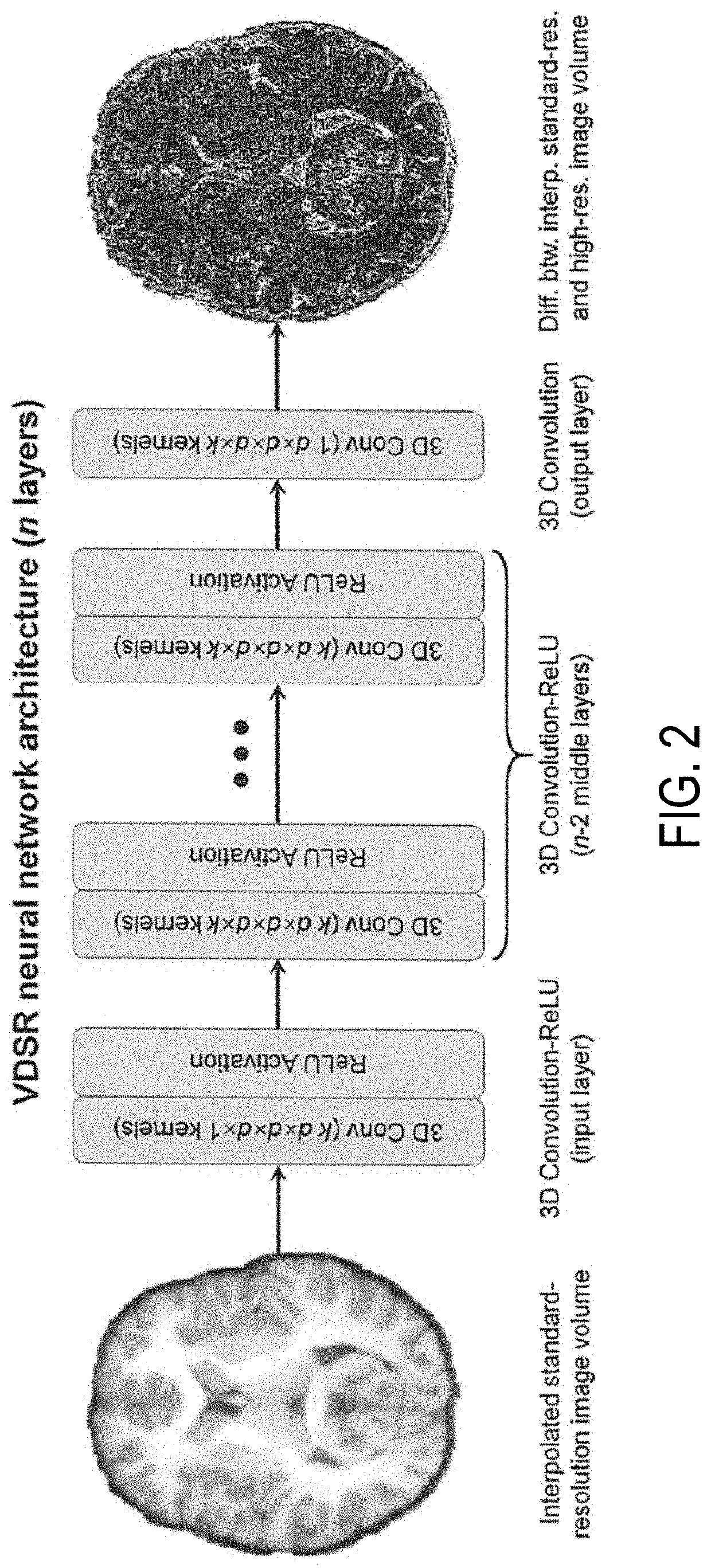 Super-resolution anatomical magnetic resonance imaging using deep learning for cerebral cortex segmentation