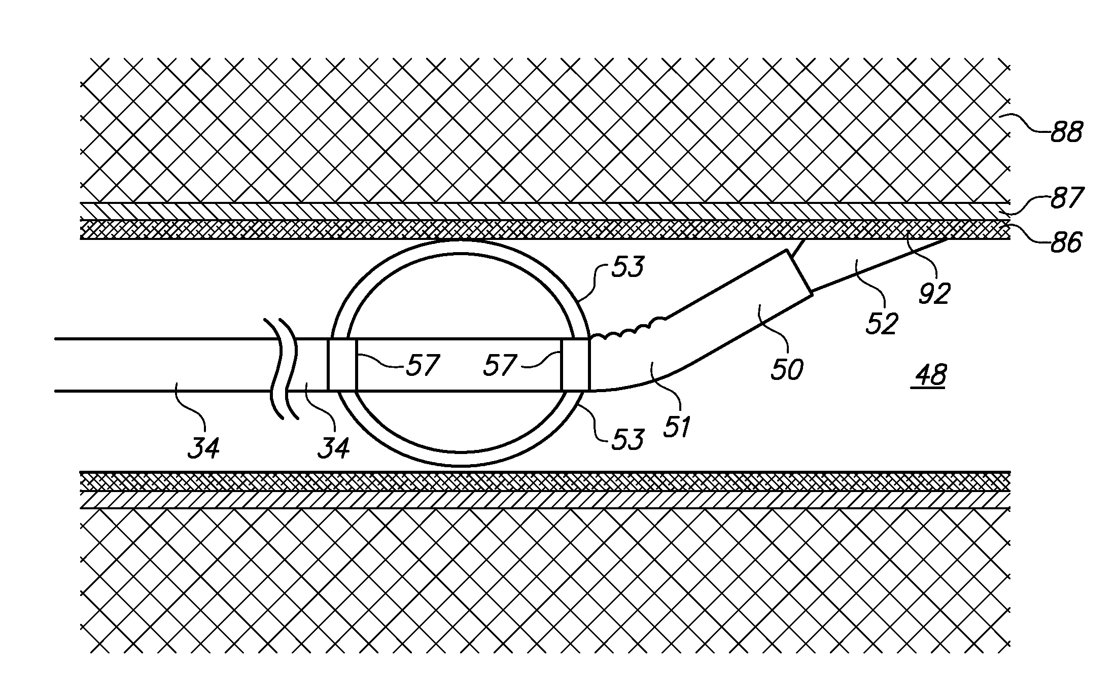 Method to control the environment in a laser path