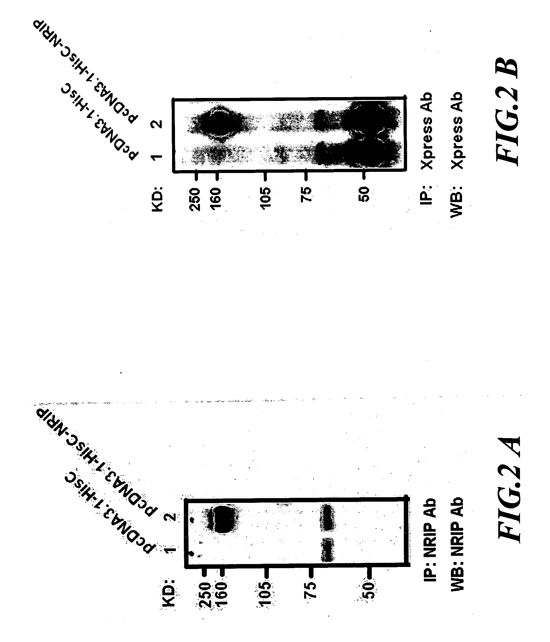 Novel diagnosis & treatment tools for cancer using the NRIP antibody and RNA interference