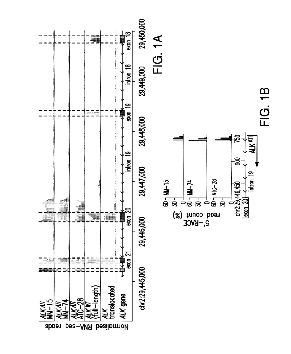 Isoform of anaplastic lymphoma kinase and its uses