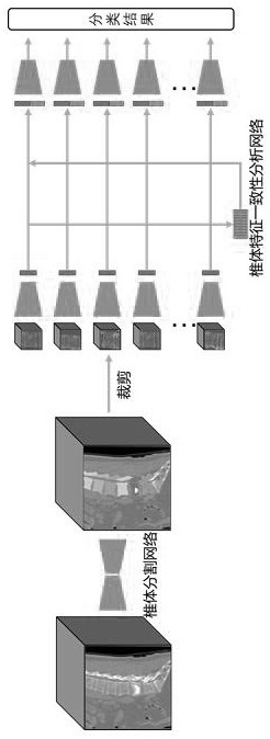 Computed tomography spinal fracture auxiliary diagnosis system