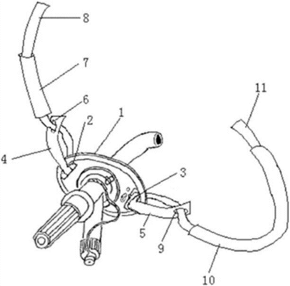 Trachea casing pipe