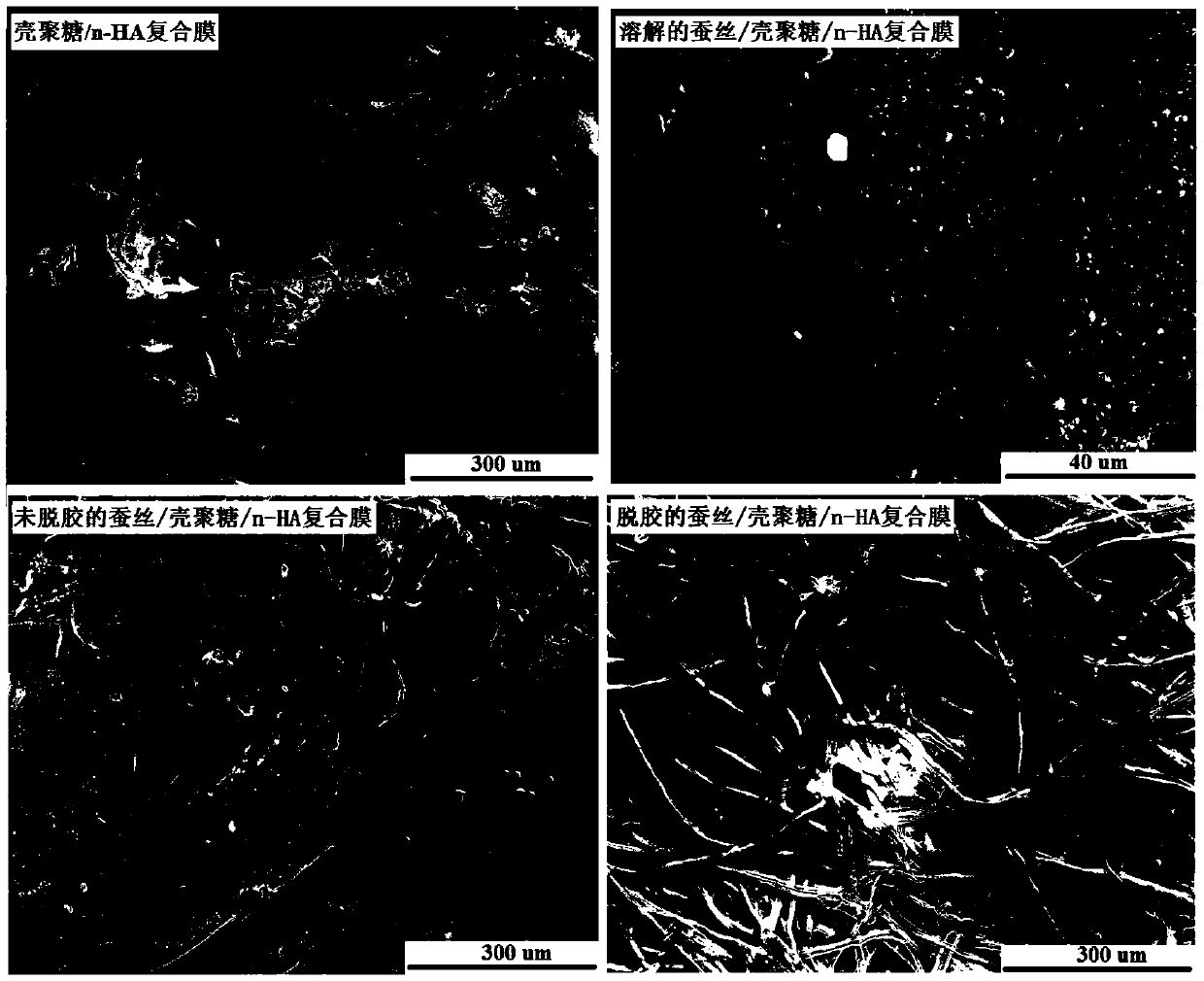 Natural silk-reinforced hydroxyapatite/chitosan composite film and preparation method thereof