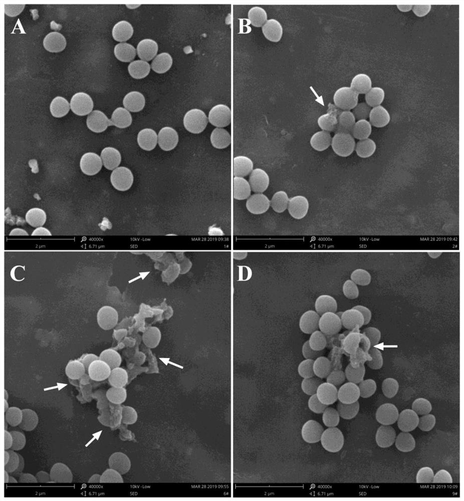 Antibacterial peptide and application thereof