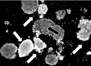 Pancreatic island freezing protective agent and using method thereof