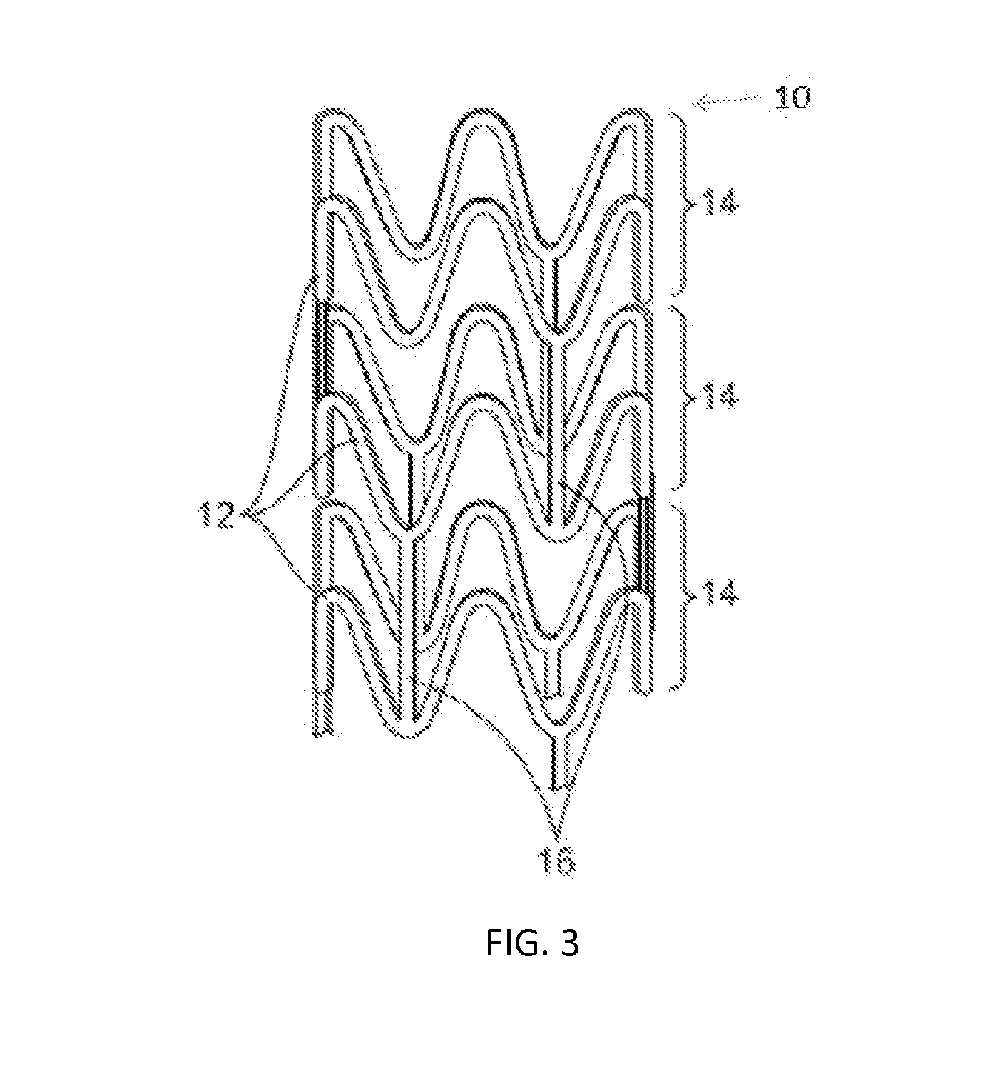 Bioresorbable implants for transmyocardial revascularization