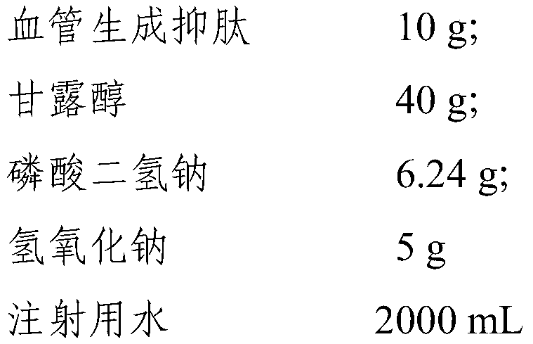 FpAT freeze-dried preparation for injection and freeze-drying method thereof