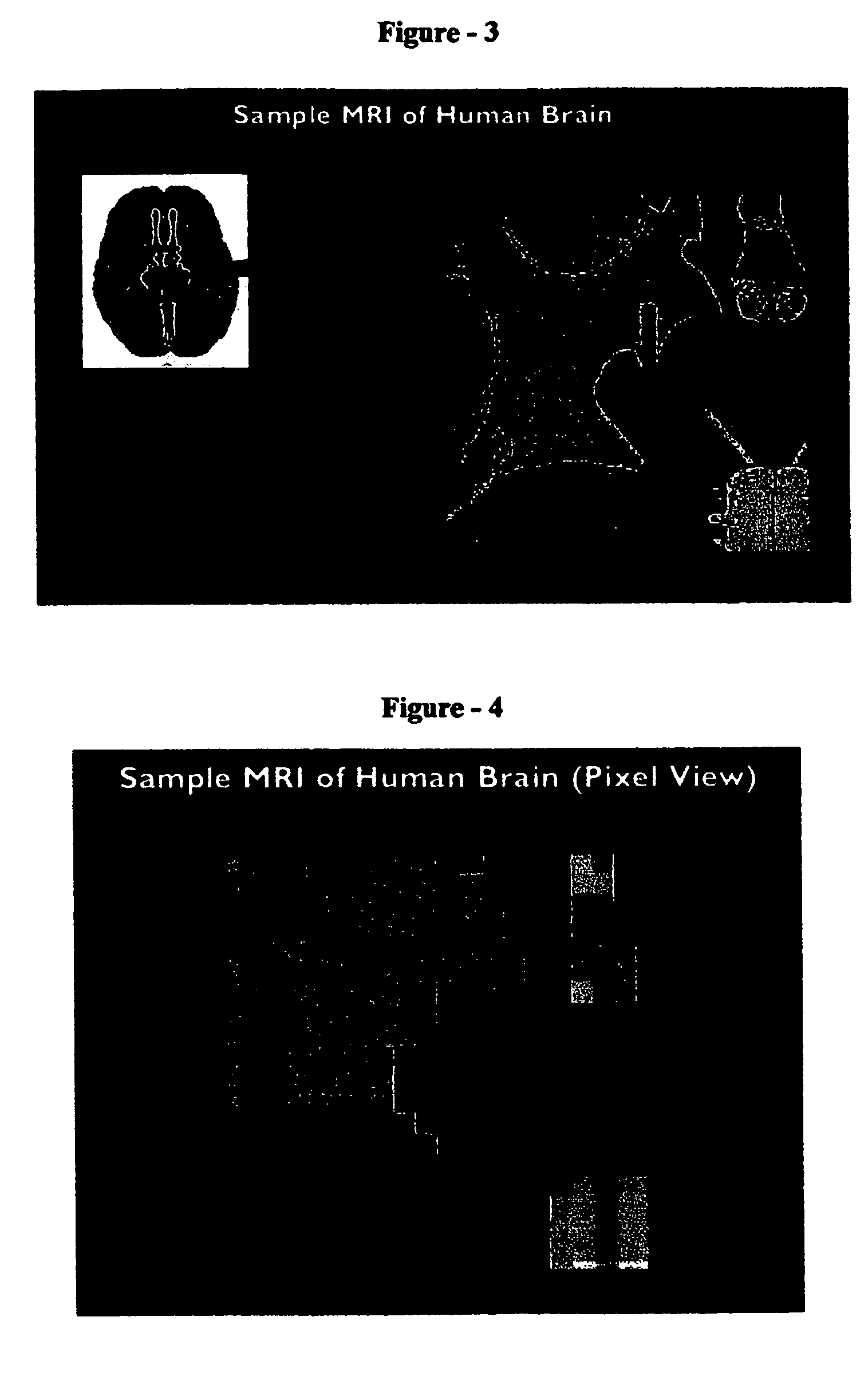 Repetition coded compression for highly correlated image data