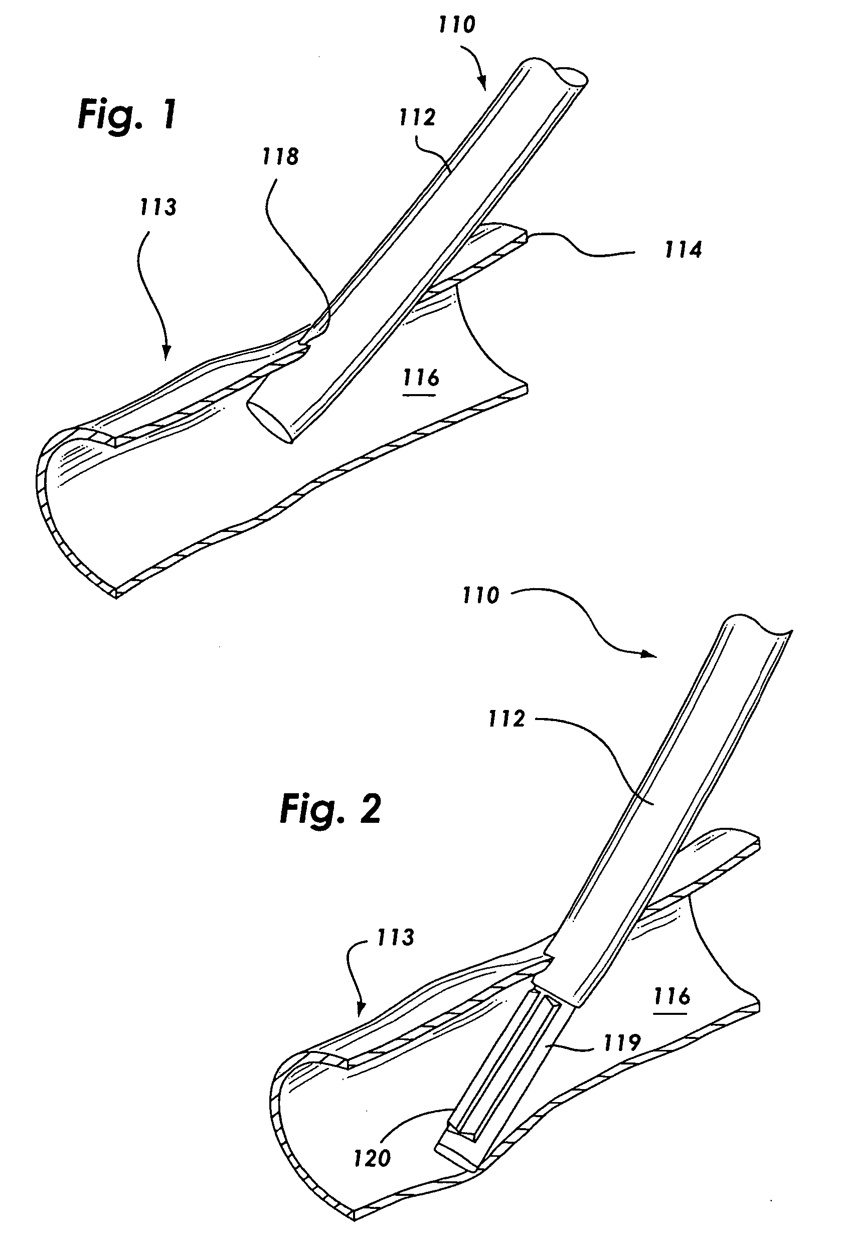 Suture based vascular closure apparatus and method incorporating a pre-tied knot