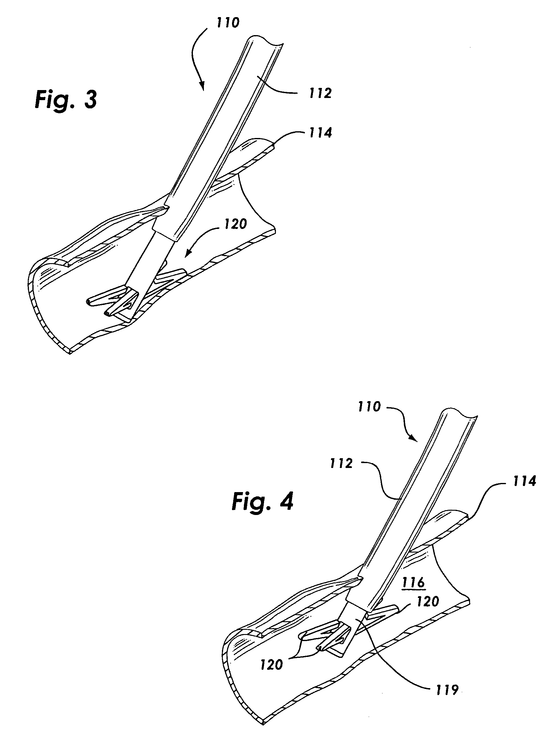 Suture based vascular closure apparatus and method incorporating a pre-tied knot