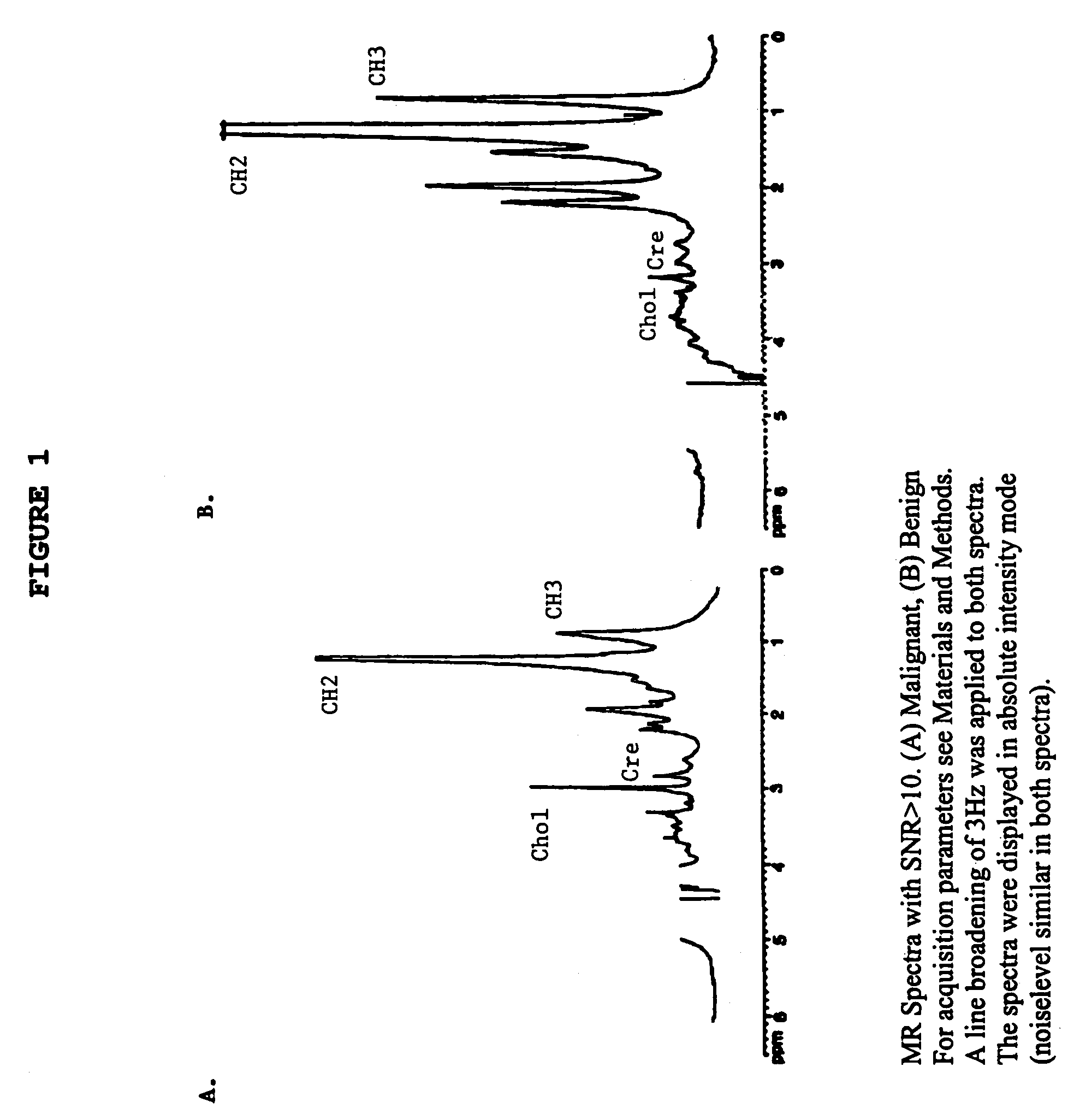 Magnetic resonance spectroscopy to classify tissue